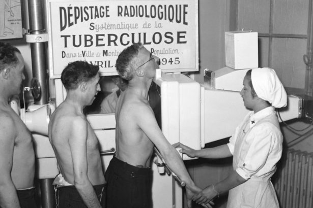 cum au ajutat tigarile ciocolata si pizza la combaterea unei epidemii de tuberculoza bbc 6730cf9e0acc8