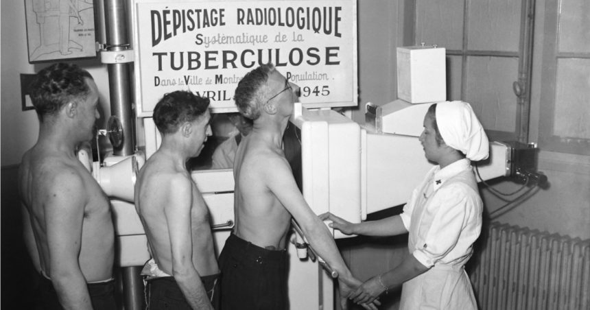 Cum au contribuit țigările, ciocolata și pizza la combaterea unei epidemii de tuberculoză (BBC) 1 cum au ajutat tigarile ciocolata si pizza la combaterea unei epidemii de tuberculoza bbc 6730cf9e0acc8