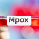 marea britanie confirma al cincilea caz de imbolnavire cu noua varianta de mpox in doar cateva saptamani 6749bf9b034ec