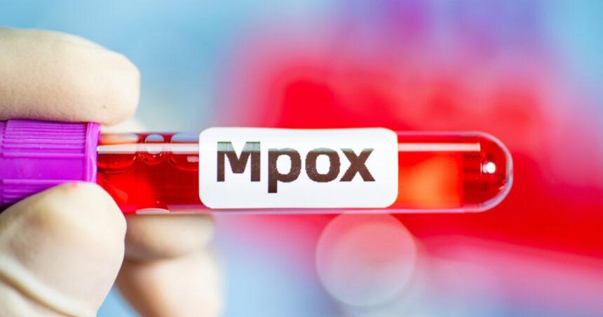 marea britanie confirma al cincilea caz de imbolnavire cu noua varianta de mpox in doar cateva saptamani 6749bf9b034ec