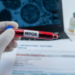 noi cazuri de infectie cu varianta mai periculoasa de mpox care sunt tarile care au confirmat imbolnaviri 674b0073348bc