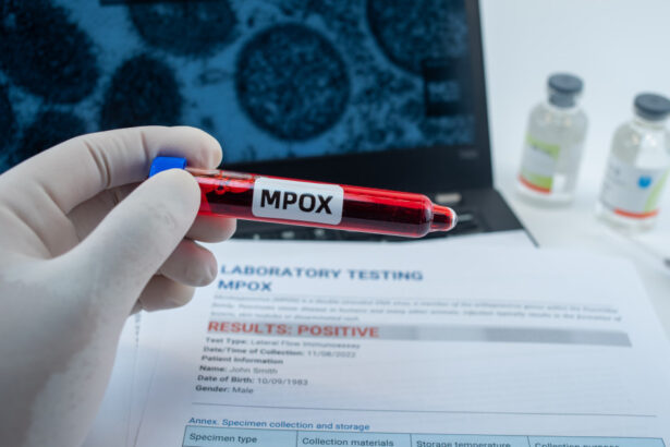 noi cazuri de infectie cu varianta mai periculoasa de mpox care sunt tarile care au confirmat imbolnaviri 674b0073348bc
