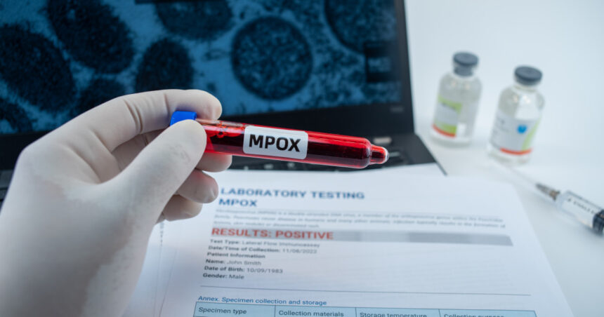 noi cazuri de infectie cu varianta mai periculoasa de mpox care sunt tarile care au confirmat imbolnaviri 674b0073348bc