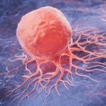numarul deceselor provocate de cancer la nivel mondial se va dubla pana in 2050 potrivit unui studiu 672b6aee493d8
