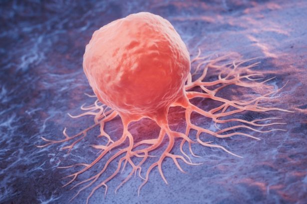 numarul deceselor provocate de cancer la nivel mondial se va dubla pana in 2050 potrivit unui studiu 672b6aee493d8