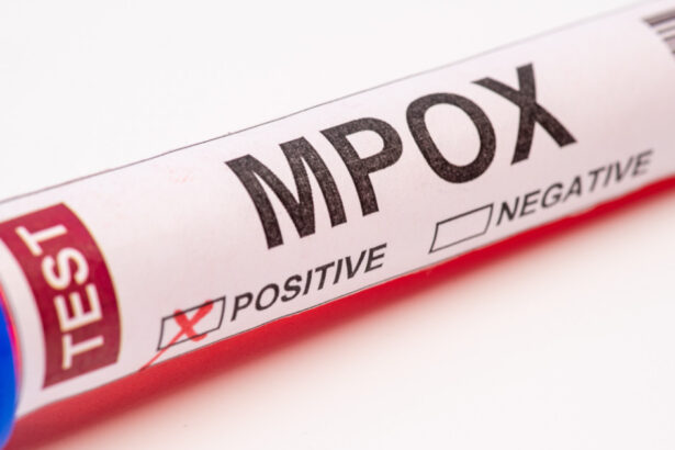 sua confirma primul sau pacient cu noua forma de mpox 673913a03a36b
