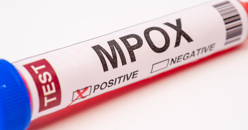 sua confirma primul sau pacient cu noua forma de mpox 673913a03a36b