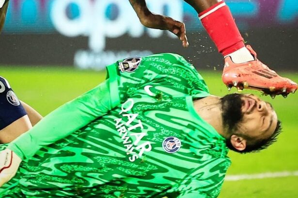 galerie foto accidentare horror pentru gianluigi donnarumma portarul lui psg desfigurat in urma unui fault criminal 6763cc9ccf14d