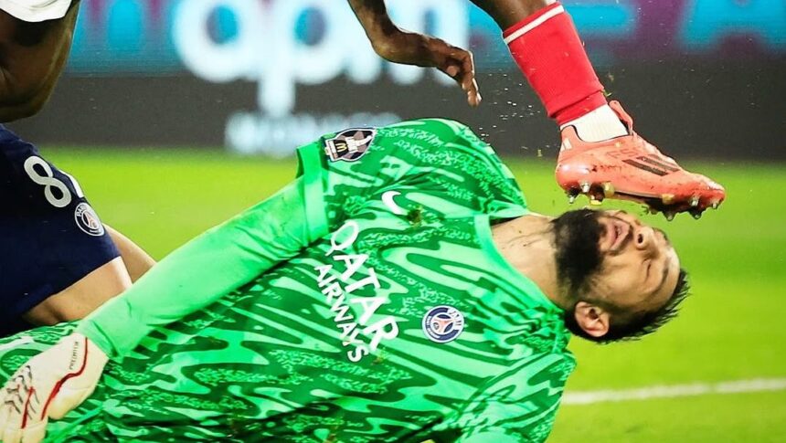 galerie foto accidentare horror pentru gianluigi donnarumma portarul lui psg desfigurat in urma unui fault criminal 6763cc9ccf14d
