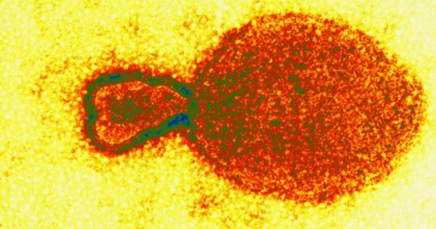 grav incident de biosecuritate sute de mostre de virusuri periculoase au disparut dintr un laborator de cercetare 6758aa7a7bc83