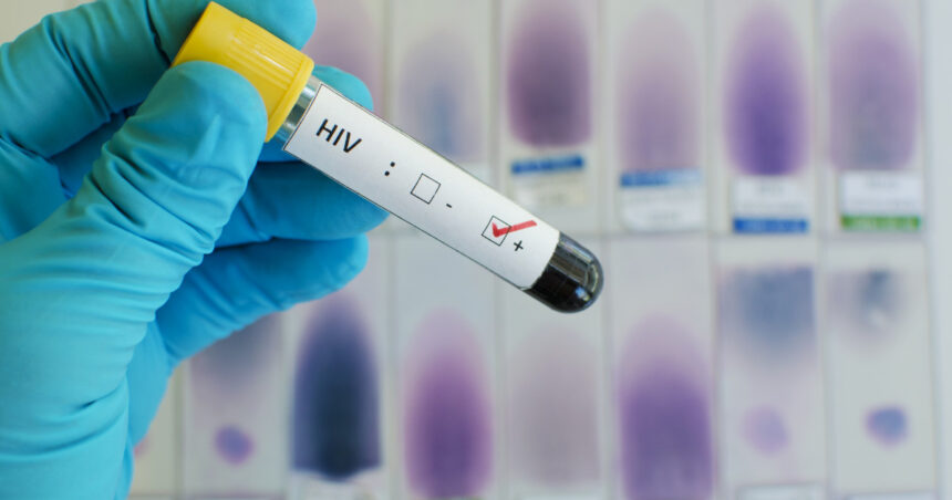 Revista Science a votat cea mai importantă descoperire ştiinţifică în 2024: Un medicament pentru prevenirea infectării cu HIV 1 revista science a votat cea mai importanta descoperire stiintifica in 2024 un medicament impotriva infectarii cu hiv 675c0ae260340
