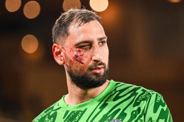 ultimele informatii despre starea lui donnarumma asta a fost marele lui noroc cum i a trecut glontul pe la ureche 6766fc2a9efb6