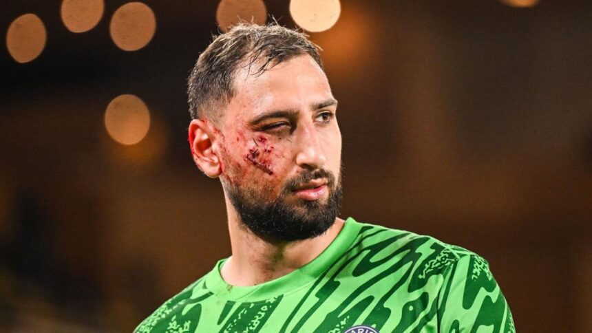 ultimele informatii despre starea lui donnarumma asta a fost marele lui noroc cum i a trecut glontul pe la ureche 6766fc2a9efb6