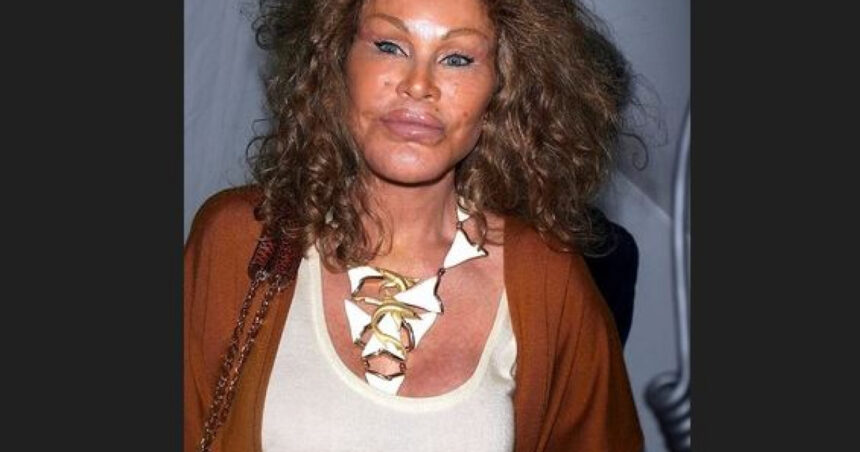 a murit catwoman jocelyn wildenstein era celebra pentru operatiile estetice extreme 677637395a6cd
