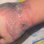 ancheta la spitalul ramnicu valcea dupa imaginile cu un copil cu mana tumefiata din cauza unei branule neschimbate de 4 zile 679b723d10d0c