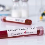 cia este mai probabil ca pandemia de covid 19 a provenit dintr un laborator si nu din natura 67963e0d65c1d