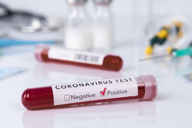 cia este mai probabil ca pandemia de covid 19 a provenit dintr un laborator si nu din natura 67963e0d65c1d