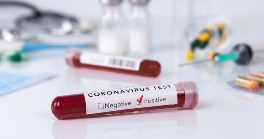 cia este mai probabil ca pandemia de covid 19 a provenit dintr un laborator si nu din natura 67963e0d65c1d