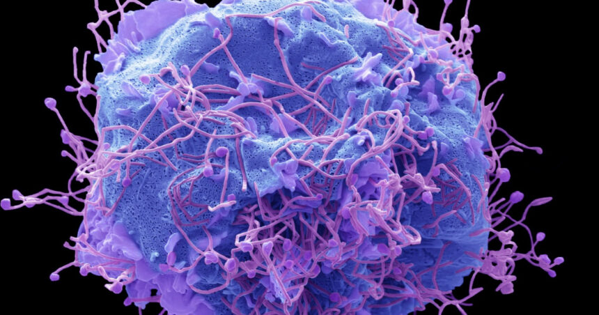După Covid, un nou virus stârnește îngrijorare în China. Ce este HMPV și care sunt simptomele acestuia? 1 dupa covid un nou virus provoaca ingrijorare in china ce este hmpv si care sunt simptomele 677c235326af7