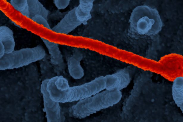 epidemie de ebola in estul africii un focar de imbolnaviri a izbucnit in uganda 679b9cb6b482e