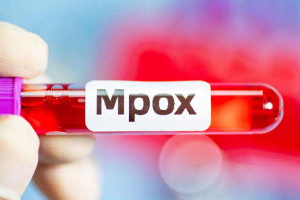 primul caz de imbolnavire cu noua varianta mpox detectat in franta 677ce842cc63b