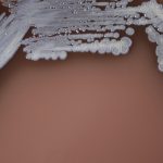 nu am mai vazut asa ceva o boala tropicala rara aparuta dupa inundatiile din nord estul australiei se raspandeste rapid 67bee0b5315e5