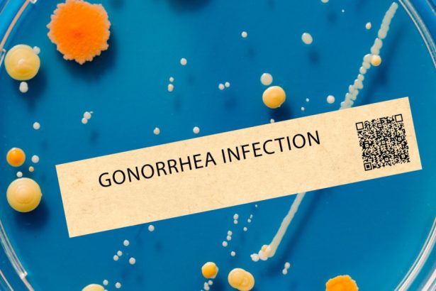 cazurile de gonoree si sifilis au atins un nivel record in europa in mai putin de zece ani infectiile s au triplat 67c4d880d1125