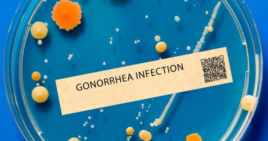 cazurile de gonoree si sifilis au atins un nivel record in europa in mai putin de zece ani infectiile s au triplat 67c4d880d1125