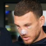 galerie foto cum si a facut aparitia edin dzeko la o zi dupa ce mihai popescu i a spart nasul situatia nu e promitatoare 67ded8ae515cc