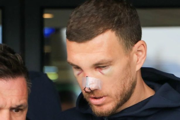 galerie foto cum si a facut aparitia edin dzeko la o zi dupa ce mihai popescu i a spart nasul situatia nu e promitatoare 67ded8ae515cc