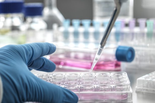 video ancheta intr un spital din tara dupa ce in laboratorul de analize au fost descoperite substante expirate reactia conducerii 67dba250b8b65