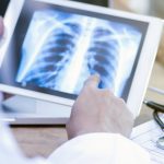 video pacientii nu isi recunosc simptomele tuberculoza face mii de victime in romania insa putini dintre bolnavi ajung la timp la medic 67e2523076bdd