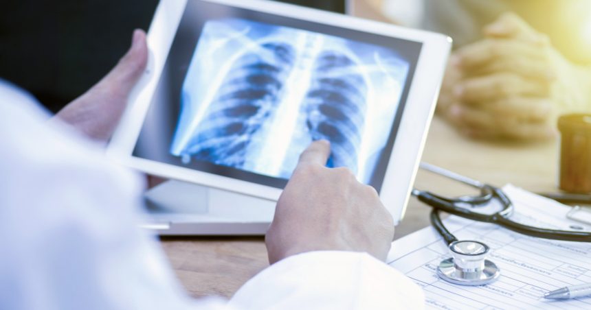 „Pacienții nu își recunosc simptomele”. Tuberculoza provoacă mii de victime în România, însă puțini dintre bolnavi se prezintă la medic la timp. 1 video pacientii nu isi recunosc simptomele tuberculoza face mii de victime in romania insa putini dintre bolnavi ajung la timp la medic 67e2523076bdd
