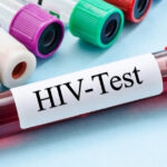 cercetatorii australieni uluiti de efectele unui nou tratament contra hiv descoperirea care ar putea duce la eradicarea virusului 6845119761e24