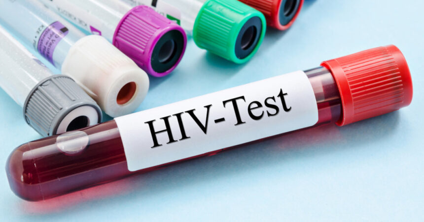 cercetatorii australieni uluiti de efectele unui nou tratament contra hiv descoperirea care ar putea duce la eradicarea virusului 6845119761e24
