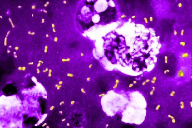 cum a evoluat cea mai letala bacterie din toate timpurile ca sa continue sa omoare milioane de oameni si sa supravietuiasca pana astazi 683e84a37b012