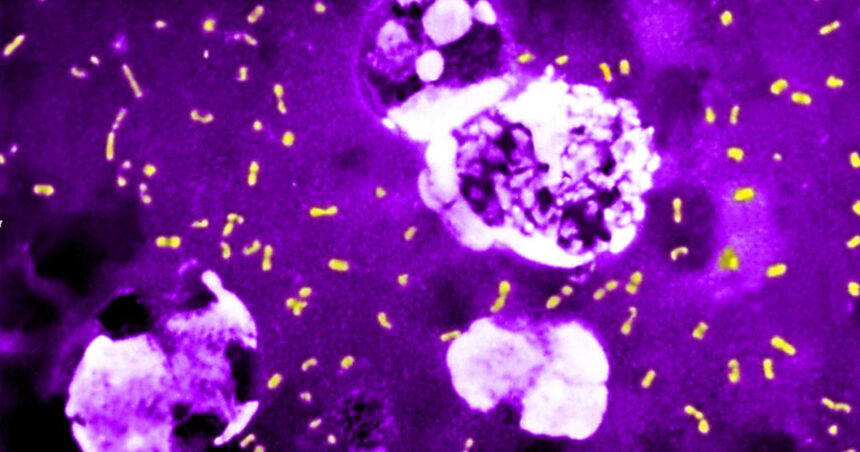 cum a evoluat cea mai letala bacterie din toate timpurile ca sa continue sa omoare milioane de oameni si sa supravietuiasca pana astazi 683e84a37b012