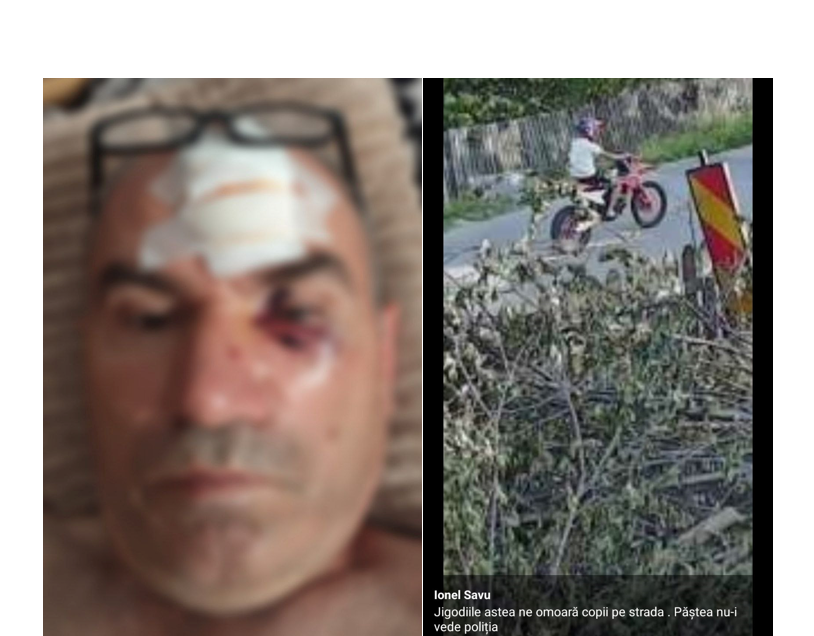 un barbat din lipnita batut mar de un consatean dupa o postare pe facebook ce s a intamplat 684555fd8b694