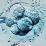 Ceasul biologic al bărbaților și legătura acestuia cu avorturile spontane în cazul fertilizării in vitro 2 ceasul biologic al barbatilor legat de avorturile spontane in cazul fertilizarii in vitro 686c0f0b69f28