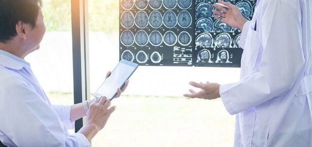 descoperiri majore ofera indicii pentru tratamentul alzheimer si parkinson 6877ed7e7a02e