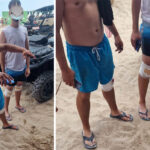 semnal de alarma la eforie doi adolescenti si au facut praf genunchii dupa ce s au lovit de stabilopozi ce transmit salvamarii 68793b8e5848c