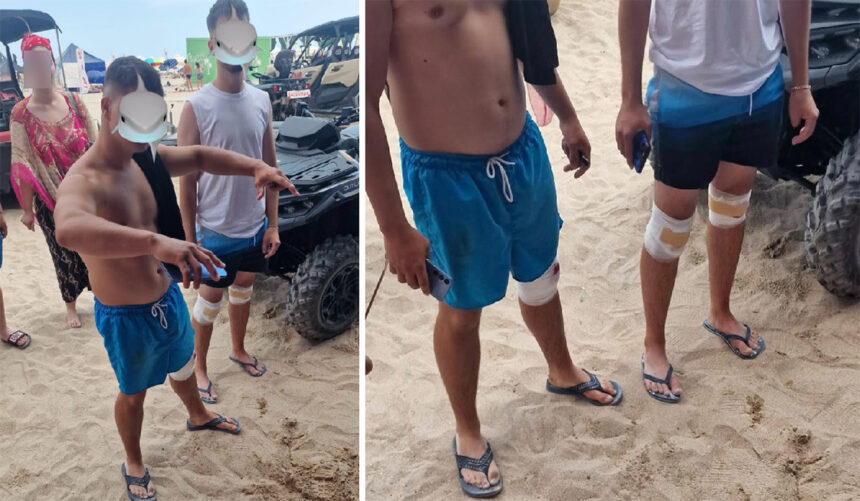 Semnal de ALARMĂ la Eforie: Doi adolescenți și-au grav rănit genunchii după ce s-au lovit de stabilopozi. Ce anunță salvamarii 1 semnal de alarma la eforie doi adolescenti si au facut praf genunchii dupa ce s au lovit de stabilopozi ce transmit salvamarii 68793b8e5848c