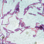 suspiciune de antrax la doua persoane internate la institutul national de boli infectioase matei bals din bucuresti 686e8f3ca8aa4