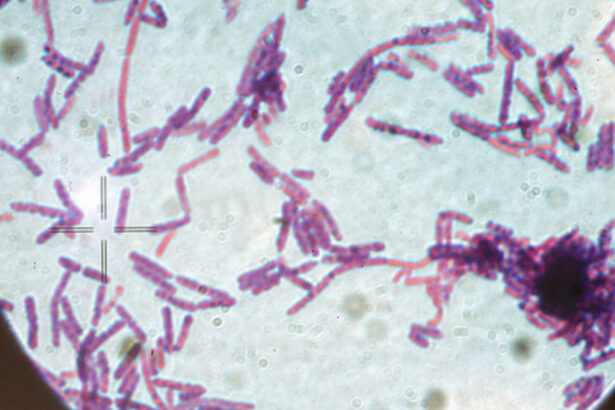 suspiciune de antrax la doua persoane internate la institutul national de boli infectioase matei bals din bucuresti 686e8f3ca8aa4