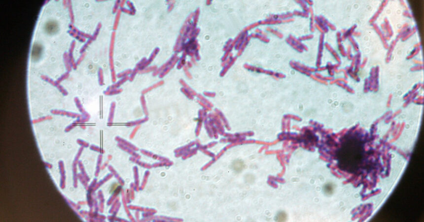 suspiciune de antrax la doua persoane internate la institutul national de boli infectioase matei bals din bucuresti 686e8f3ca8aa4