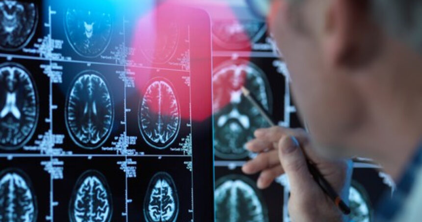 Un medicament pentru tratarea bolii Alzheimer în stadii timpurii este aproape de autorizare în UE: informații despre donanemab. 1 un medicament pentru tratarea bolii alzheimer in stadii timpurii este aproape de autorizare in ue ce este donanemab 68861b96ed40c