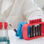 un test de sange ar putea detecta prezenta mutatiilor maligne cu 3 ani inainte de aparitia primelor simptome de cancer arata un studiu 6864b5968c838