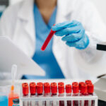 un test de sange ar putea depista cu precizie cancerul ovarian in stadii incipiente studiu 68ad7ae5aeb5c