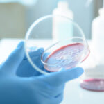 ce este serratia marcescens bacteria descoperita la spitalul sfanta maria din iasi unde au murit sase copii 68d6951d8e44f