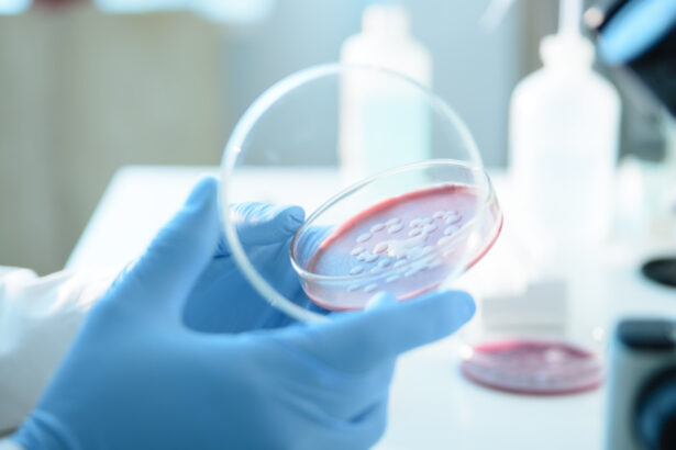 ce este serratia marcescens bacteria descoperita la spitalul sfanta maria din iasi unde au murit sase copii 68d6951d8e44f